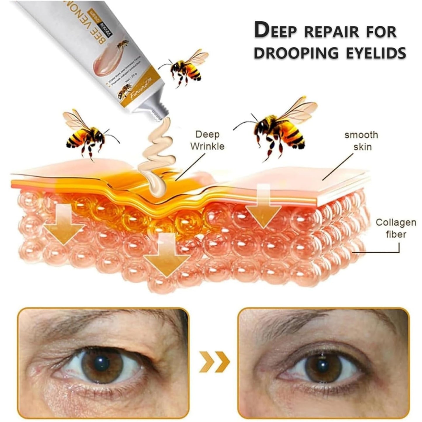Bee Veno-m Wrinkle Removal Cream,Bee Ven-om Skin Treatment Cream,Be-e Ven-Om Cre-Am,Be-E Ve-Nom Cr-Eam For Wrinkles,Skin Tightening Serum,Rebuild The Face Barrier,Moisturizing,Soothing,Anti-Aging