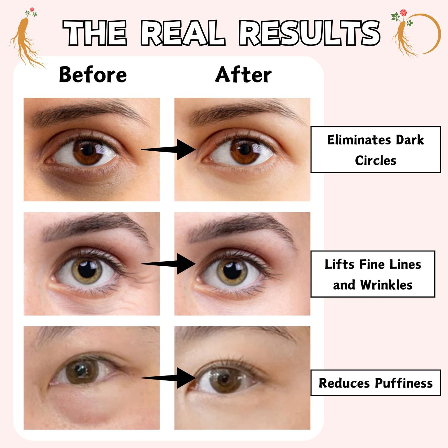 Revive Eye Serum: Ginseng + Retinal, Advanced Eye Cream for Dark Circles And Puffy Eyes, Hydrating Anti Wrinkle Eye Creams, Eyes Cream Anti Aging for Wonen&Men, Korean Skincare, 30ml