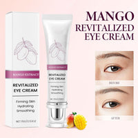 Siyinzu Eyelift Serum Mango Revitalize Eye Cream,Mango Activating and Firming Eye Cream,Hyaluronic Acid Repair Cream,E/ye Cre/am for Dark Circles and Puffy Eyes,Under Ey/e Cre/am,Anti Aging Ey/e Crea/m