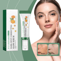 Siyinzu Dark Spot Correcting Glow Serum with 5% Niacinamide,Niacinamide Serum,Dark Spot Remover for Face,Skin Brightening Serums to Even Skin Tone,Dark Spots Correcting Serums,Face Serums Women,Facial Cream