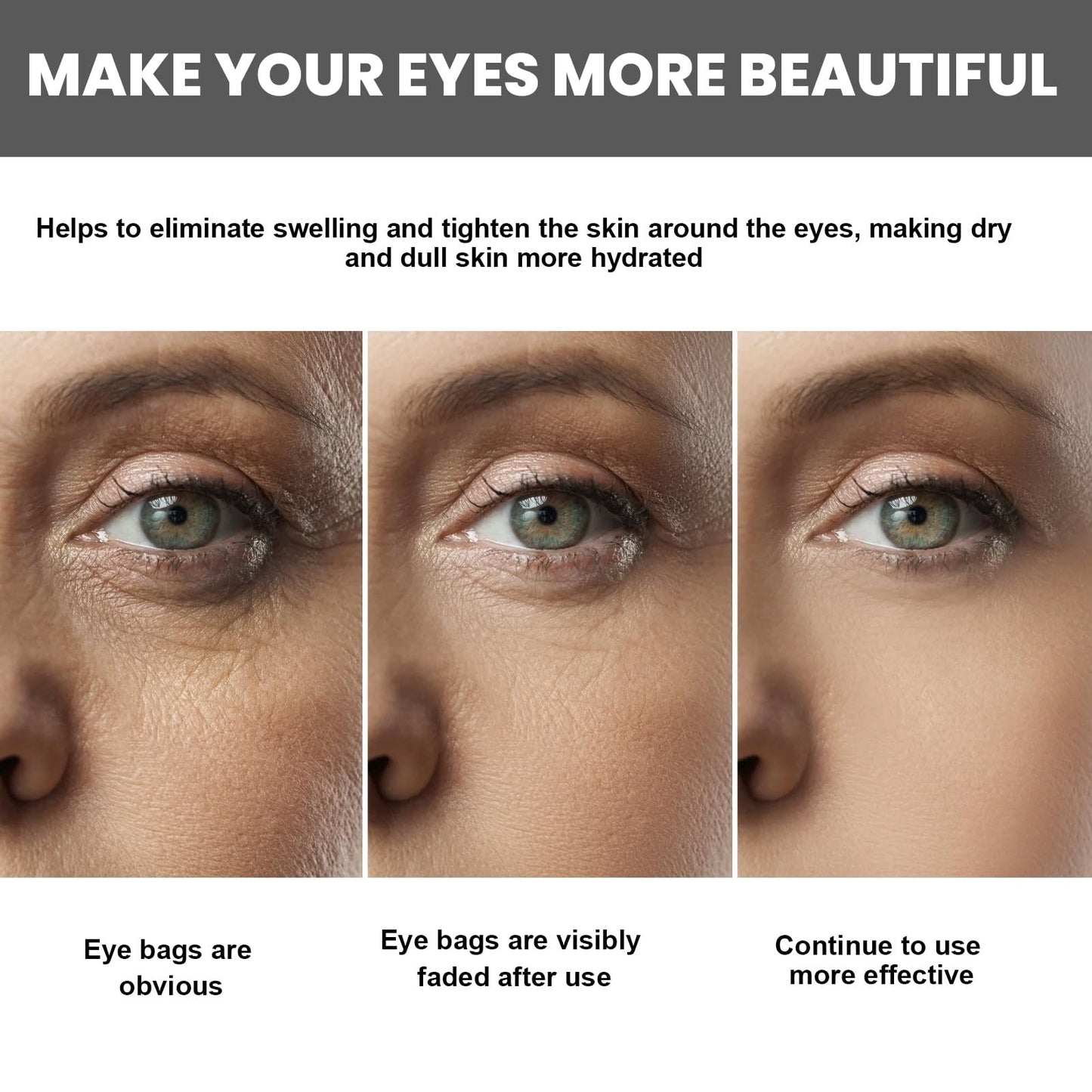 Retinol Intense Reactivating Eye Cream,Retinol Eye Cream,Dark Circles Under Eye Treatment Women,Anti Aging Eye Cream,Eye Cream for Dark Circles and Puffy Eyes,Eye Bags Remover,Eye Cream for Wrinkles