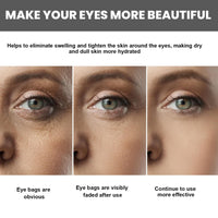 Retinol Intense Reactivating Eye Cream,Retinol Eye Cream,Dark Circles Under Eye Treatment Women,Anti Aging Eye Cream,Eye Cream for Dark Circles and Puffy Eyes,Eye Bags Remover,Eye Cream for Wrinkles