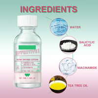 Overnight Drying Lotion, Spot Treatment for Acne, Anti-Blemish Drying Lotion For Blemishes 30ml Anti Acne Treatment Face Serum for Facial Pimples/Zits, Acne Control, Reduce Redness