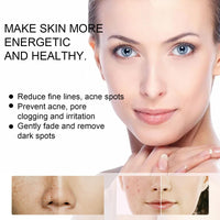 Siyinzu Dark Spot Remover Cream for Face & Body,Anti Aging Fac/e Cream,Dark Spot Remover,Freckle Removel Cre/am,Age Spot Remover for F/ace,Dark Spot Corrector Firming Fa/ce Moisturiser,Moisturiser Face Women