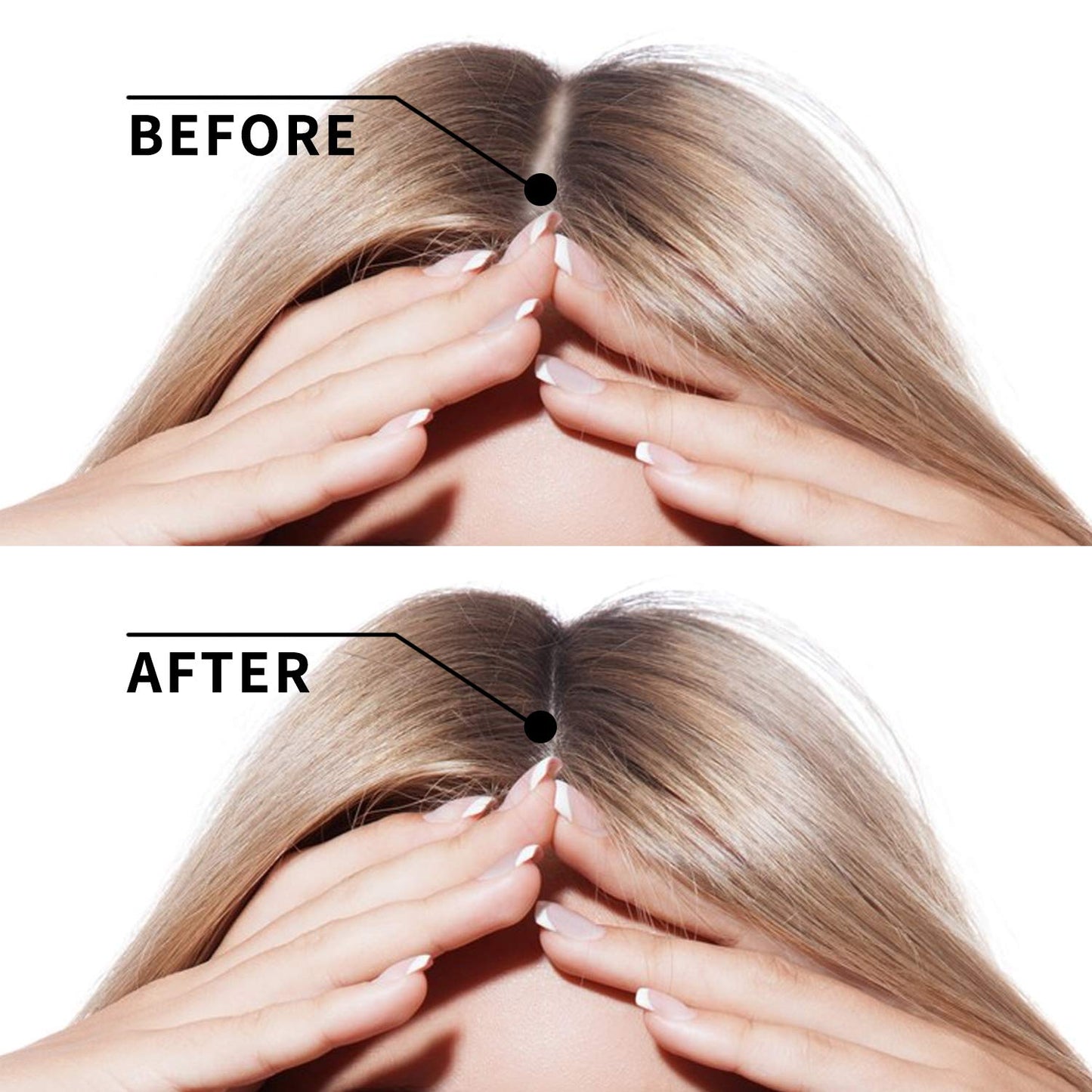 Hair Growth Serum vitamins serum for Hair Loss and Hair Regrowth Ginger Hair Growth Oil for Thinning/Balding/Repairs Hair Follicles/Stronger Hair Hair Growth Treatment for Men and Women