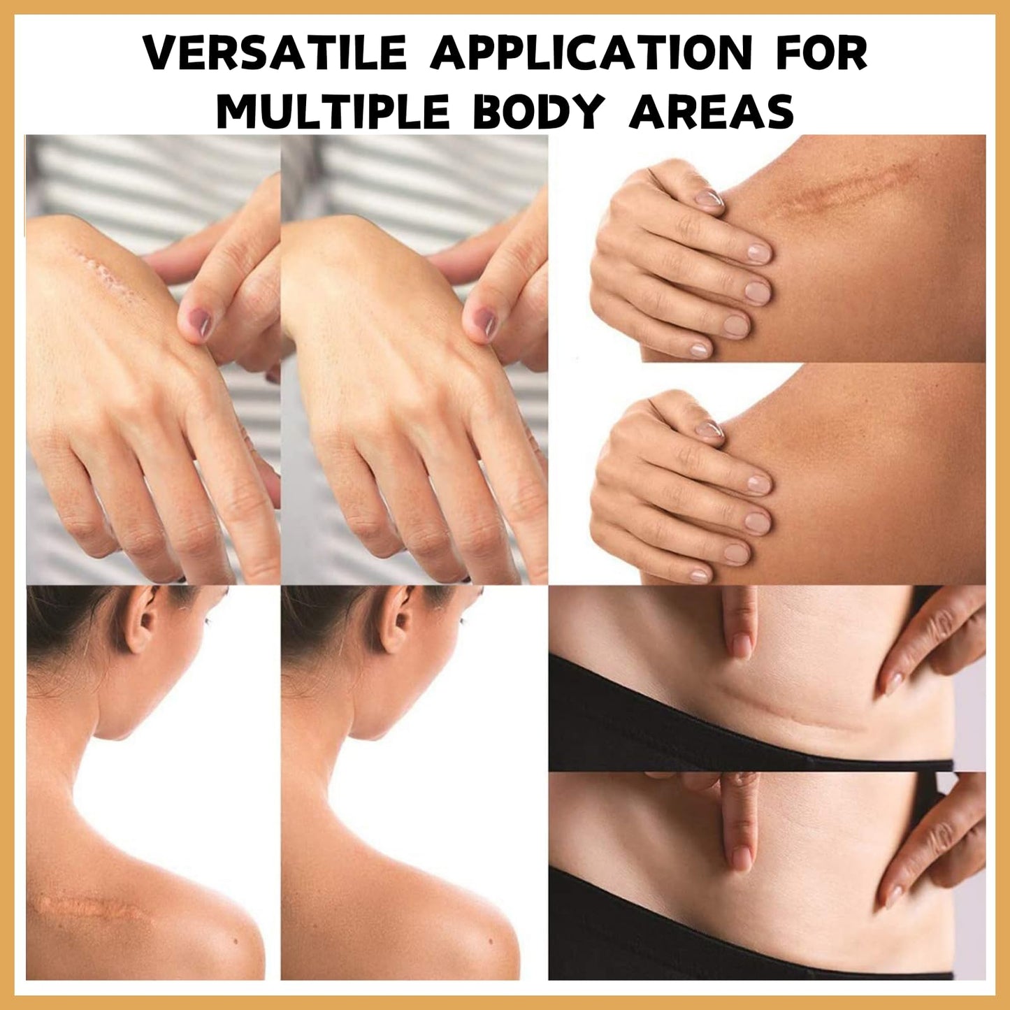 SHEBEEDO 6pcs A Kit Tattoo Cover Up Tape Invisible Scar Cover-Up Tattoo Cover Up Patch Tattoo Makeup Cover Up Waterproof Long Lasting Coverage For Face Arms Legs And Other Areas Perfect For Hiding Tattoos Scar