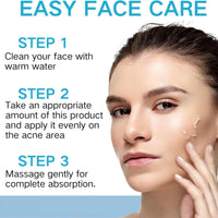 Acne Control Cream for Face,Face Serum for Acne Treatment,Acne Gel Fast Absorbing Spot Treatment,Fast Acting Spot Treat/ment for Fa/ce,Fungal Acn/e Treatm/ent for Women,Gel for Sp/ot Prone Skin