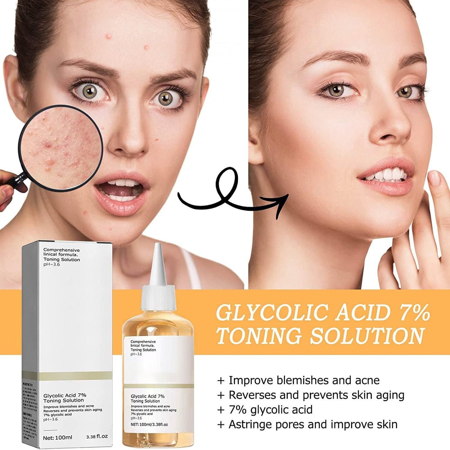 SUNDEER Glycolic Acid Toner, Glycolic Acid 7% Toning Resurfacing Solution, Skincare Hyaluronic Acid Serum, Hydrating Toning Solution, Brighten & Strengthen Your Skin (100ml)