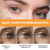 Bee Ven-om Eye Cream,Collagen Bee Veno-m Wake Up Eye-Cream,Wrinkle Removal Skin Treatment Cream,Be-e Ven-om Wrinkle Removal Cream,Ey-e Cr-eam Anti Aging,Under E-ye Cre-am,Firming Ey-e Crea-m