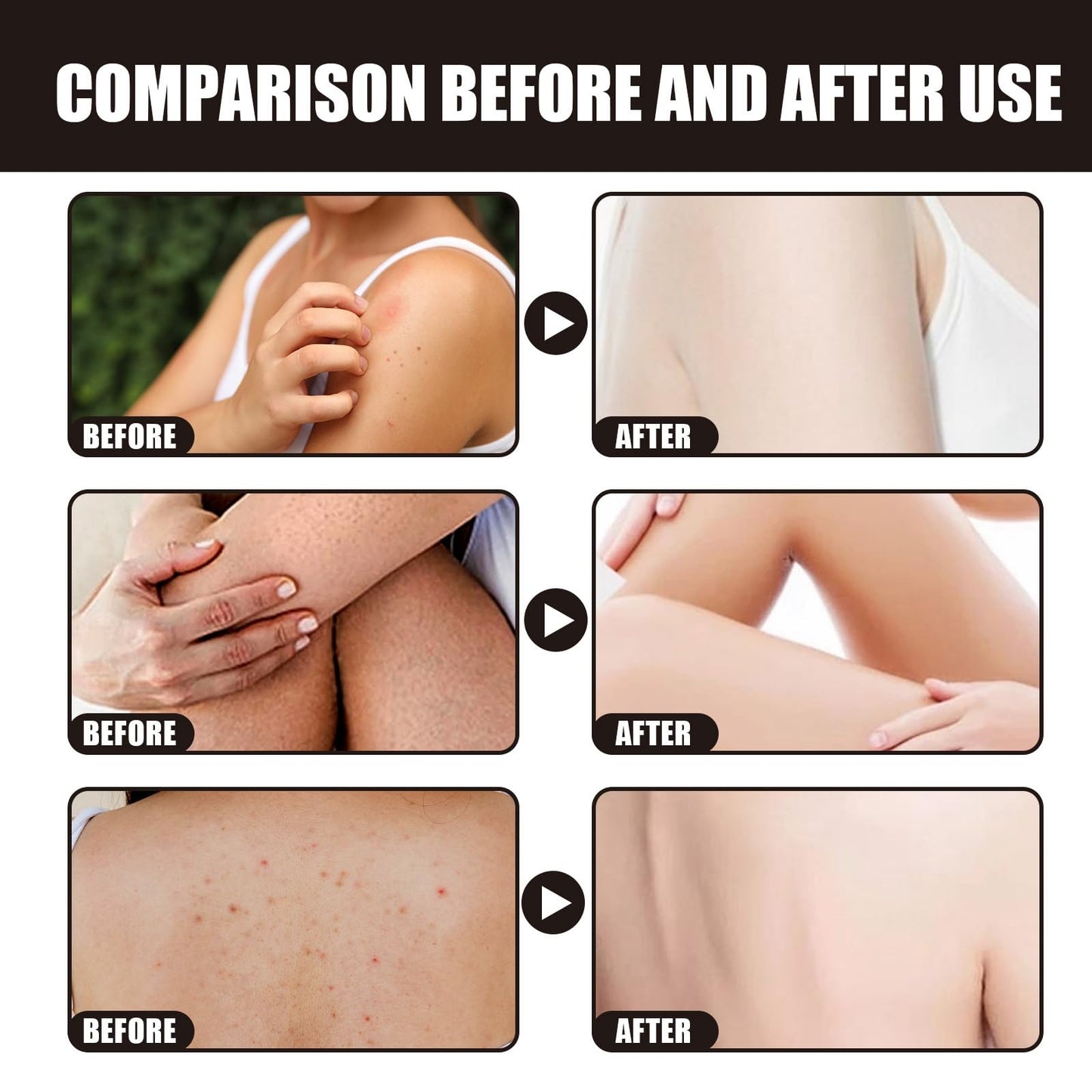 Oumun Colour Corrector Concealer,Leg Makeup Waterproof No Transfer,Leg Makeup Lotion,Leg Vein Cover up Makeup,Leg and Body Scar Cover up Makeup,Concealer Full Coverage,Makeup Concealer,Light Concealer,02#
