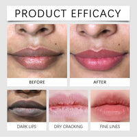 Ruojiar Brightening Lip Balm for Smo/kers and Non-Smo/kers,Lip Lightening Cream for Dark Lips,Lip Plumping Lip Gloss,Lip Lightening Scrub Balm,Natural Ingredients,Refreshing and Not Sticky,Deep Moisturizing