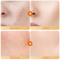 FALILUV Turmeric Face Cream, Anti Aging Face Cream For Skin Lightening, Anti Wrinkle Face Cream,Dark Spot Corrector Remover For Face, Erase Fine Lines,Firming Face Moisturiser
