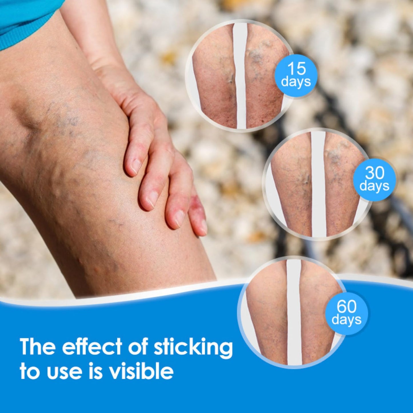 2PCS Va-ricose V-eins Cream, Va-ricose V-eins Treatment for Legs, Herbal Balm to Reduce Swelling in Feet and Legs, Spider v-eins Repair Cream for Women & Men, Vegan Legs Swelling Relief, 20g × 2