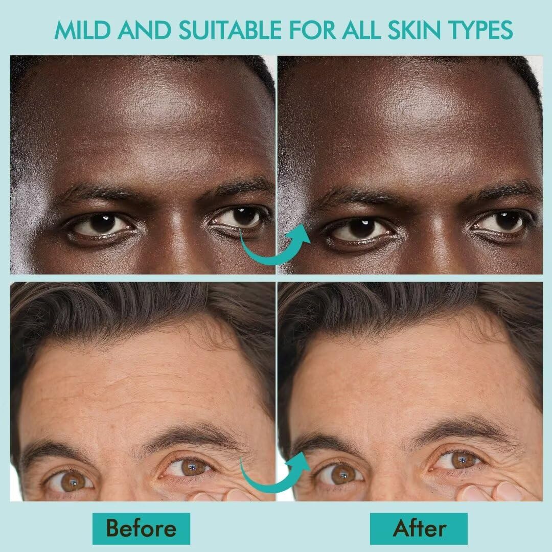 AUSLKA Men's Forehead Wrinkle Patches, Anti-Wrinkle Facial Treatment, Smooth Fine Lines & Wrinkles 24PCS