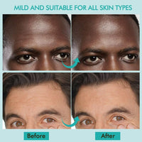 AUSLKA Men's Forehead Wrinkle Patches, Anti-Wrinkle Facial Treatment, Smooth Fine Lines & Wrinkles 24PCS