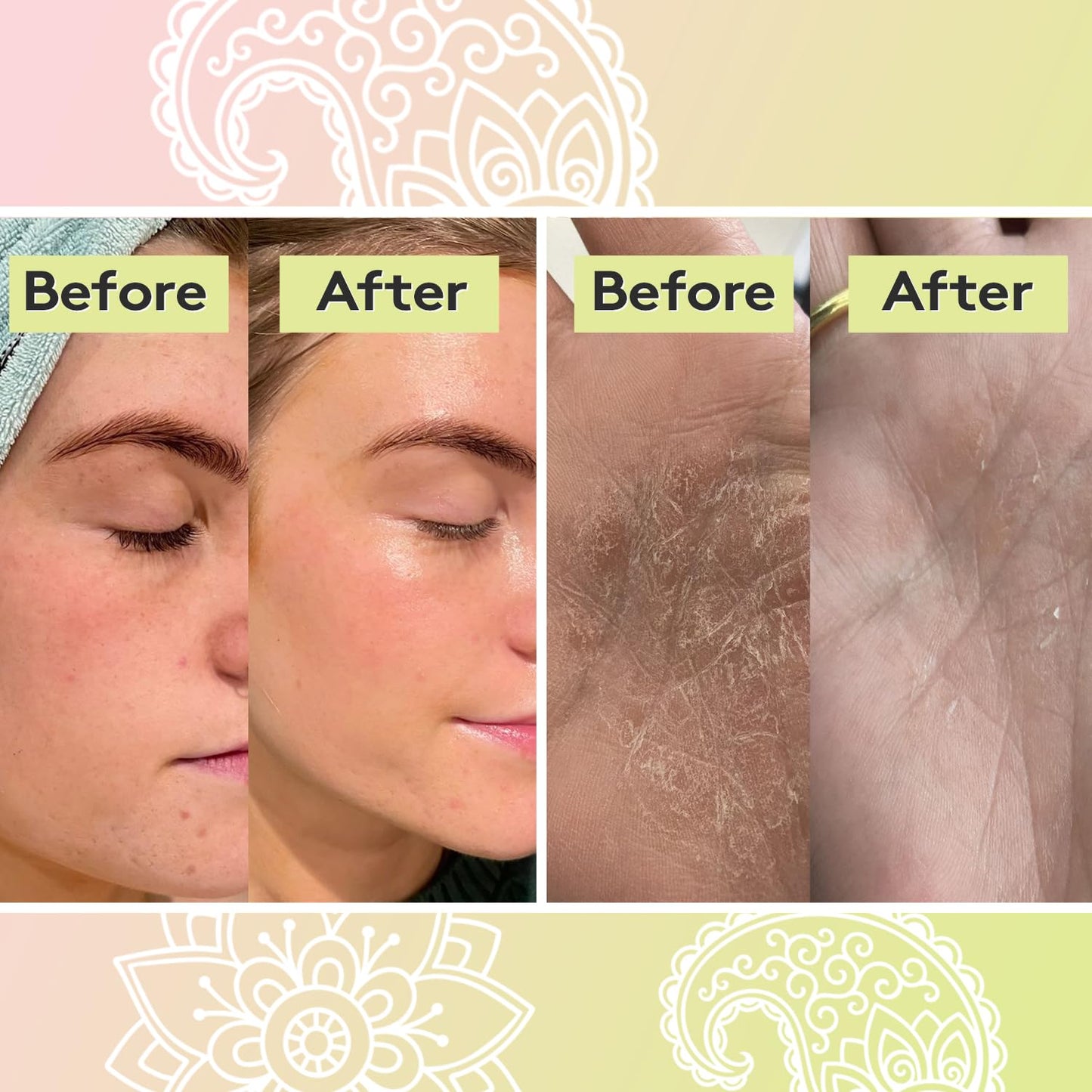 Delhicious Anti-Ageing Overnight Face Drops - Hydrating Face Serum & Scar Treatment - Nourishing & Brightening - Moon Moisture Apricot & Rosehip Oil - Natural, Vegan, Ayurveda - 40ml