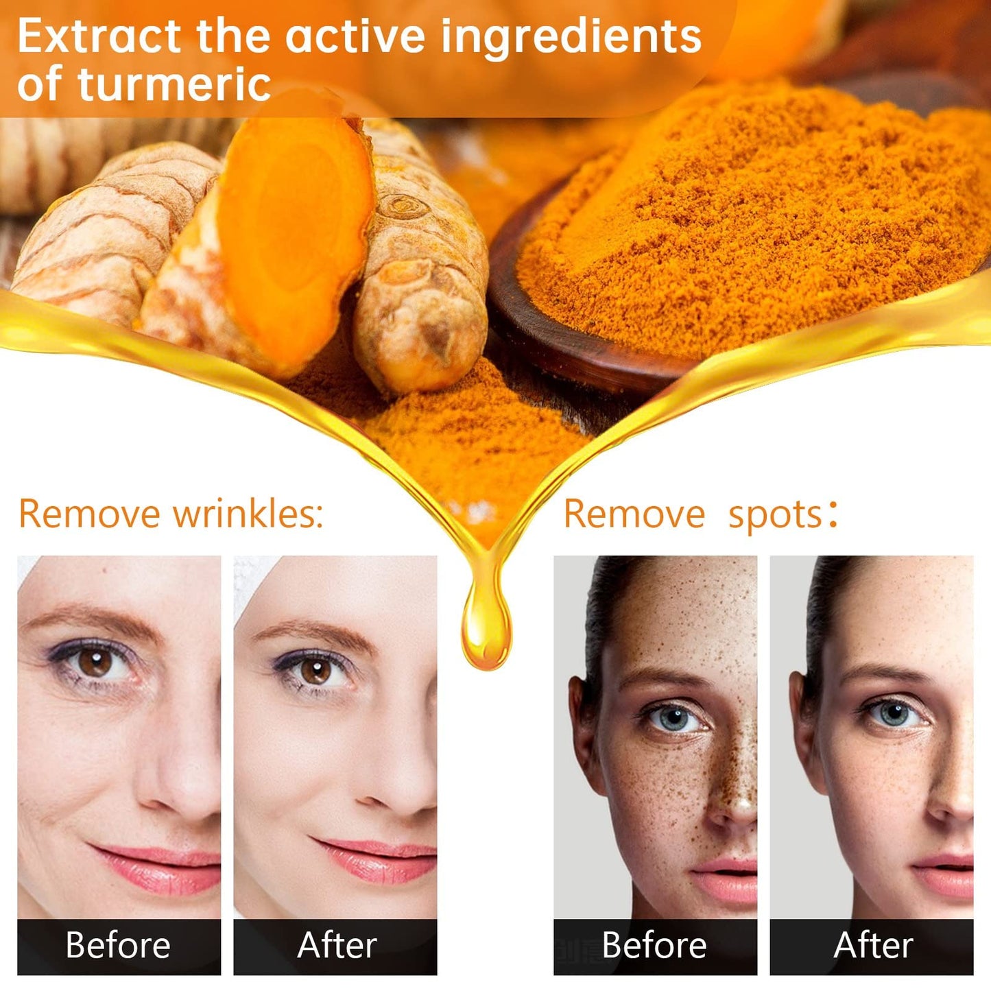 Turmeric Dark Spot Corrector Serum Oil, Turmeric Serum for Dark Spots Remover,Brightening Skincare for Hyperpigmentation, Acne Scars & Age Spots
