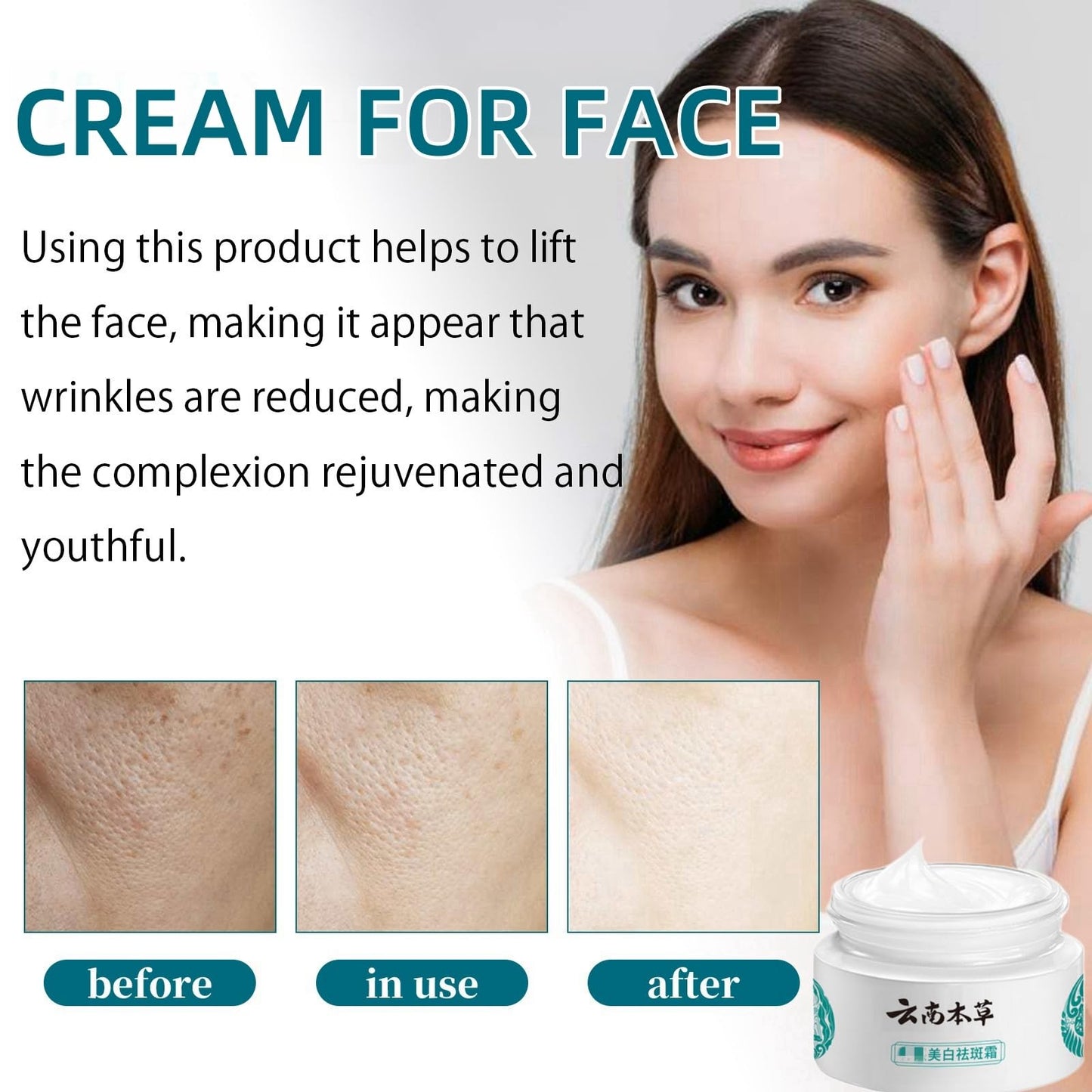 White Spot Cream,Herbal Freckle-Removing Cream,Lightening Cream for Face,Dark Spot Remover for Face,Dark Spot Corrector,Spot Cream,Freckle Removal Cream,Age Spot Remover for Face,Dark Spot Serum