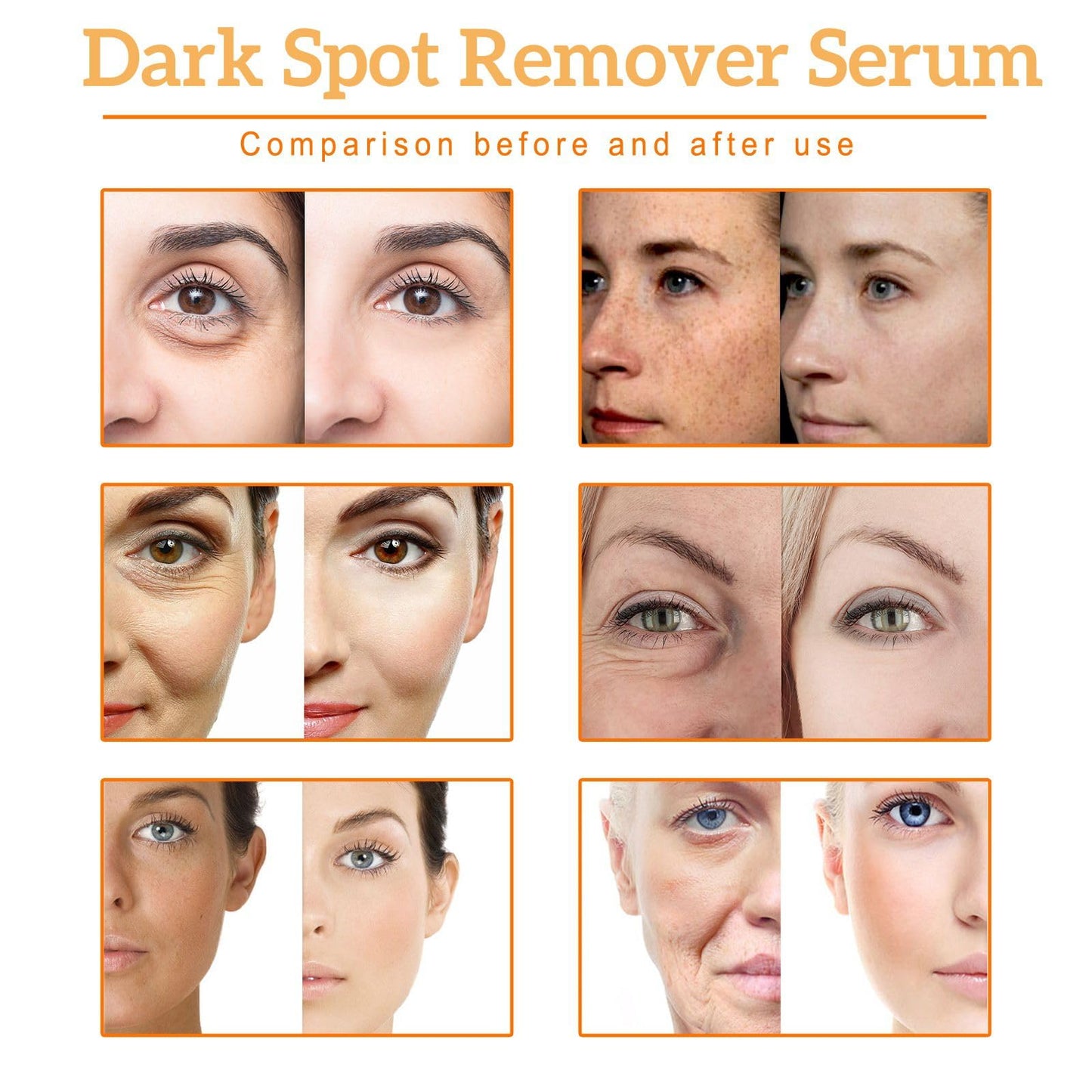 Fankayi Dark Spot Remover Serum,Dark Spot Correcting Glow Serum,Turmeric Serum for Face,Se-rum for Skin Lightening,Fa-ce Se-rum for Women,Anti Wrinkle Face Cream,Hydrating Seru-m,Brightening Ser-um