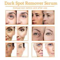 Fankayi Dark Spot Remover Serum,Dark Spot Correcting Glow Serum,Turmeric Serum for Face,Se-rum for Skin Lightening,Fa-ce Se-rum for Women,Anti Wrinkle Face Cream,Hydrating Seru-m,Brightening Ser-um