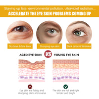 QUIWEN Turmeric Eye Cream, Turmeric Under Eye Cream, Eye Bags Remover, Anti Wrinkle Eye Cream, Firming Eye Cream, For Puffy Eyes, Moisturizes Eye Area