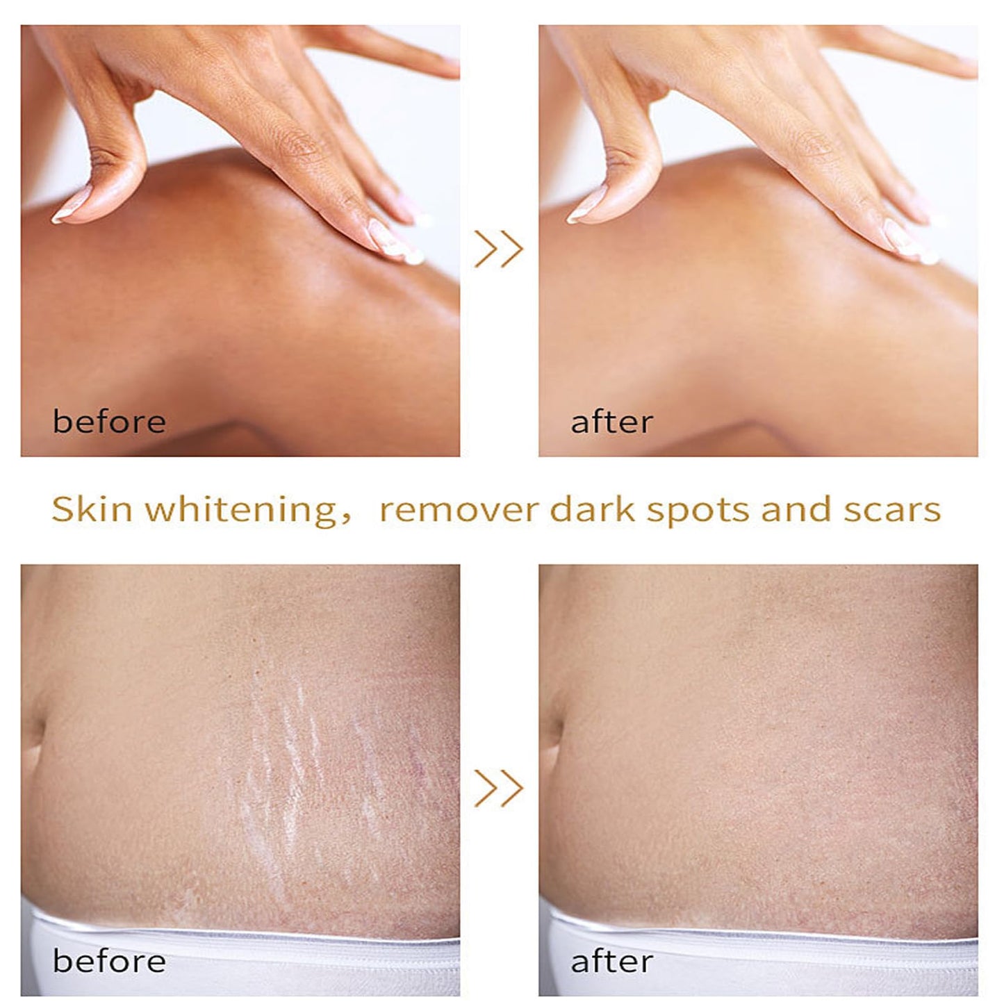Yellow Peeling Oil - Lightening Exfoliating Dark Skin For Body, Strong Peeling Oil, Skin Peeling Oil For Skin Lightening, Peeling Oil For Skin Brightening Moisturizing, Peeling Solution Dark Skin
