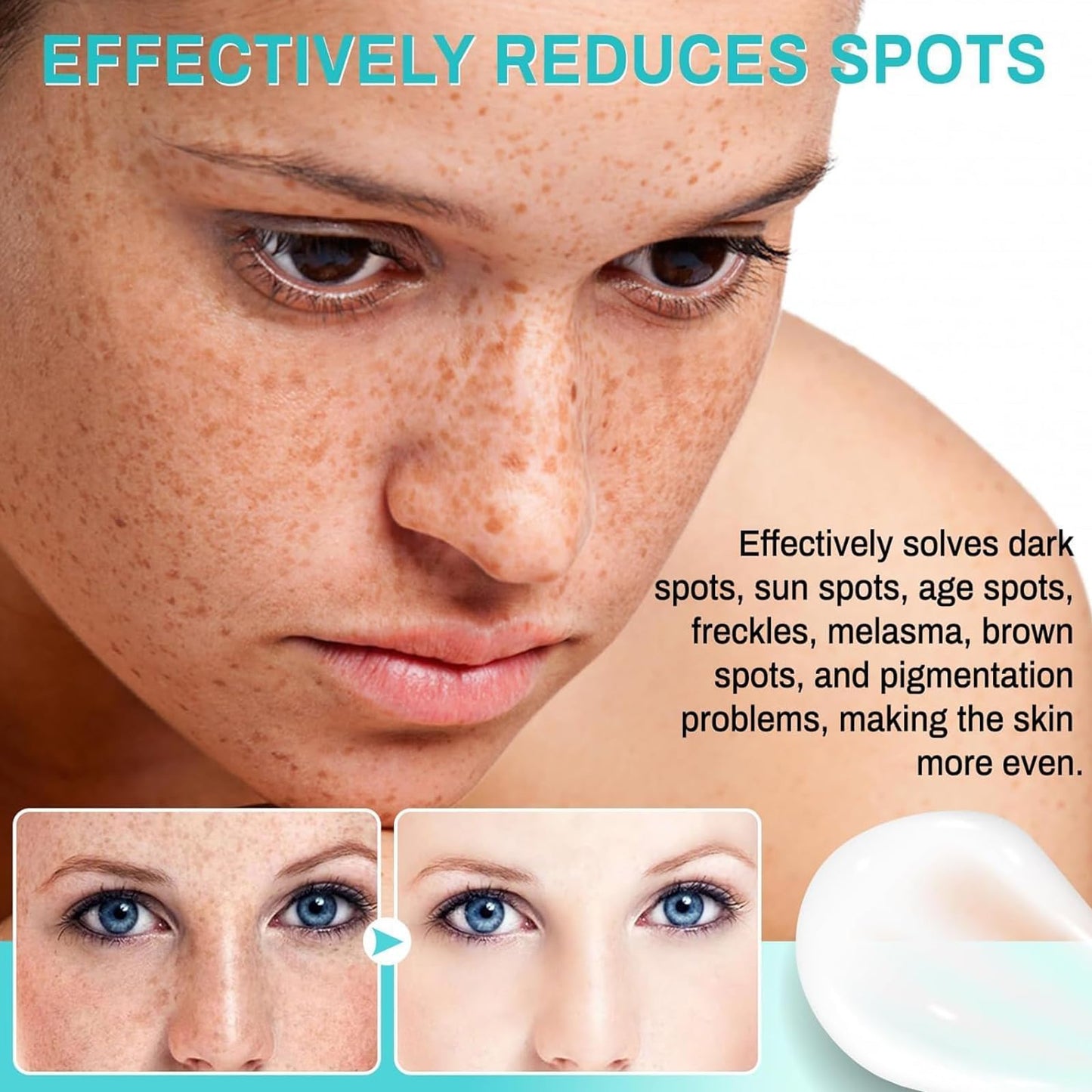 2PCS Dark Spot Remover, Dark Spot Remover For Face, Dark Spot Corrector, Age Spot Remover For Face, Pigmentation Removal Cream Prevent Forming Dark Spots, Fade Spots, Improve Skin Tone (30G*2)