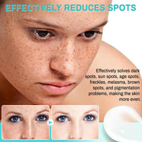 2PCS Dark Spot Remover, Dark Spot Remover For Face, Dark Spot Corrector, Age Spot Remover For Face, Pigmentation Removal Cream Prevent Forming Dark Spots, Fade Spots, Improve Skin Tone (30G*2)