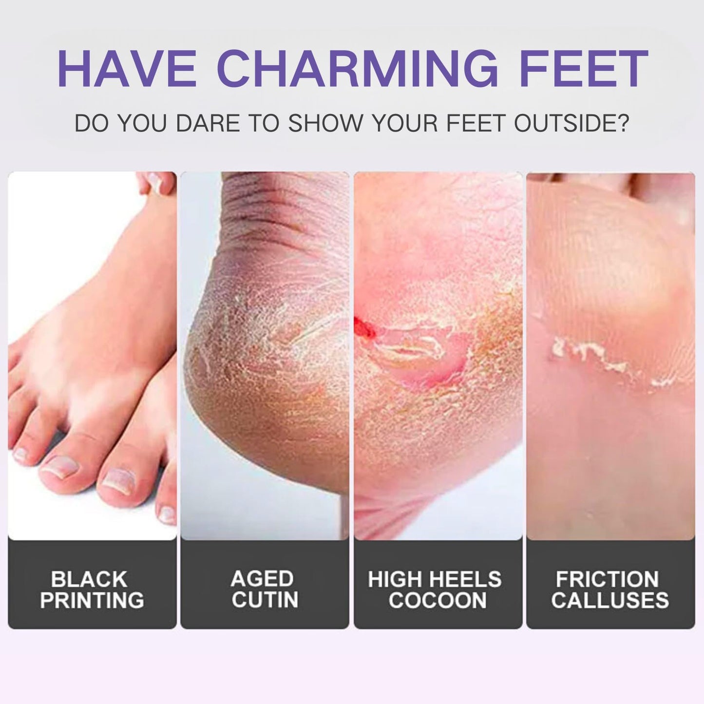7PCS Foot Peel Mask for Hard Skin & Feet Scrubber & Socks, Exfoliating Foot Peel Mask, Callus Remover for Feet, Foot Moisturiser Socks for Foot Care