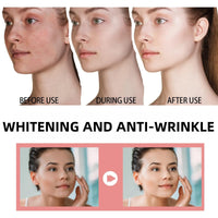 Whitening Anti-Wrinkle Cream,Firming Anti Aging Face Cream,Pigmentation Removal Cream,Dark Spot Remover for Face,Freckle Remove Anti Wrinkle F-ace Crea-m,Whitening Fa-ce Cre-am for All Skin Type