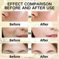 Koj-Ic Acid Turmeric Collagen Night Wrapping Mask,Turmeric And Koj-Ic Acid Face Mask,Turm-Eric Face Ma-Sk,Overnight Brightening Fa-Ce Ma-Sk,Nourishes Dull Uneven Skin&Improved Elasticity,Deep Hydrat