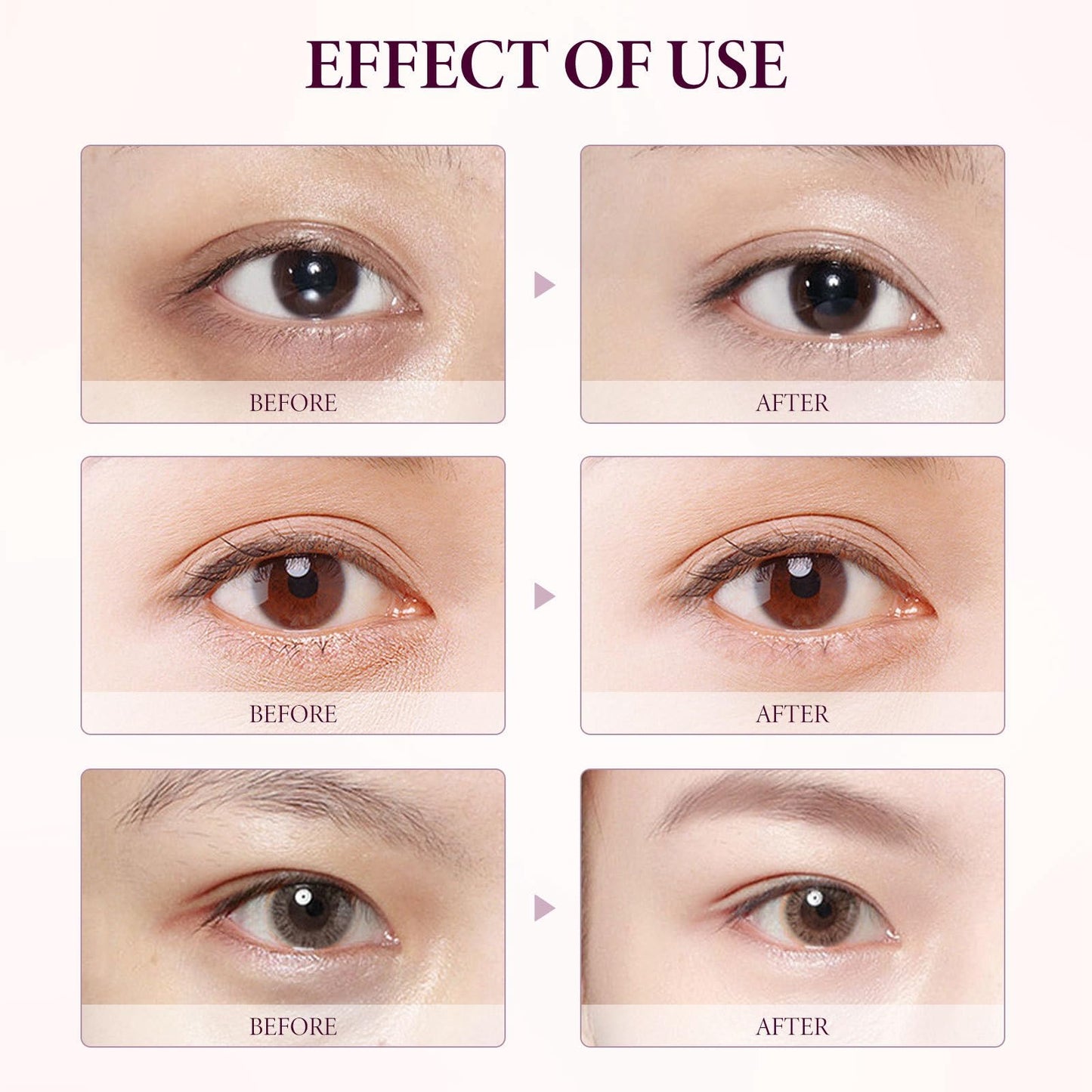 Siyinzu Eyelift Serum Mango Revitalize Eye Cream,Mango Activating and Firming Eye Cream,Hyaluronic Acid Repair Cream,E/ye Cre/am for Dark Circles and Puffy Eyes,Under Ey/e Cre/am,Anti Aging Ey/e Crea/m