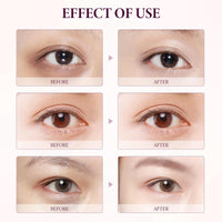Siyinzu Eyelift Serum Mango Revitalize Eye Cream,Mango Activating and Firming Eye Cream,Hyaluronic Acid Repair Cream,E/ye Cre/am for Dark Circles and Puffy Eyes,Under Ey/e Cre/am,Anti Aging Ey/e Crea/m
