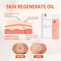 Oumun 125ml Optimal Oil,Stretch Mark & Scar Treatment Skincare Oil,Body Oil Skin Care,Skin Regenerate Oil,Collagen Boost Firming & Lifting Skincare Oil,Body Oil for Women,Stretch Marks Removal,Facial Oil