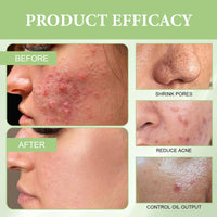 Purifying Exfoliating Gel Pore-Shrinking, Moisturizing Skin Cleanser, Exfoliating Gel Efficient for Removing Aging Keratin and Impurities, Purifying Enzymes Exfoliating Gel for Home and Travel Use