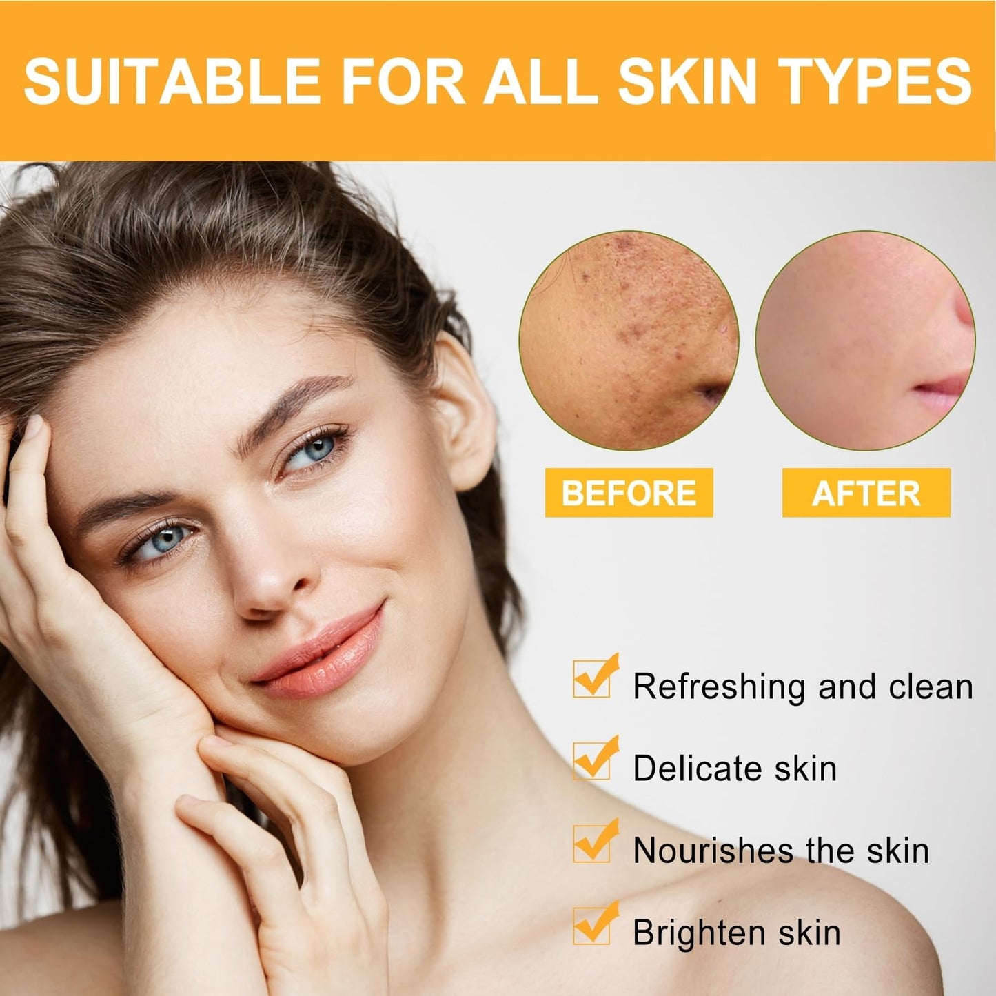 OuXing Spot Cream,Spot Treatment,Spot Remover,Spot Treatment for Face,Cream for Dark Skin Treatment,Anti Aging Face Cream,Spot Remover for Face,Freckle Removal Cream,Spot Corrector,Age Spot Remover for Face