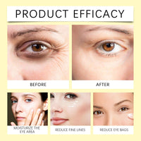 OuXing Vitamin C Turmeric Eye Cream Anti Aging,Eye Cream,Under Eye Cr-eam for Da-rk Circles,Dar-k Circle E-y-e Cream,E-ye Cre-am for Da-rk Cir-cles and Puffy E-ye,Ey-e Cre-am Anti Aging,15g