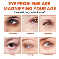 Rollerbal Lutein Eye Essence Oil,Vitamin C Lutein Eye Essence Oil,Lutein Anti-Wrinkle Esse-nce O-il,E-ye Bags Remover,Ey-e Cream for Dark Circles,E-ye Cream for Wrinkles,Ey-e Serum for Dark Circles