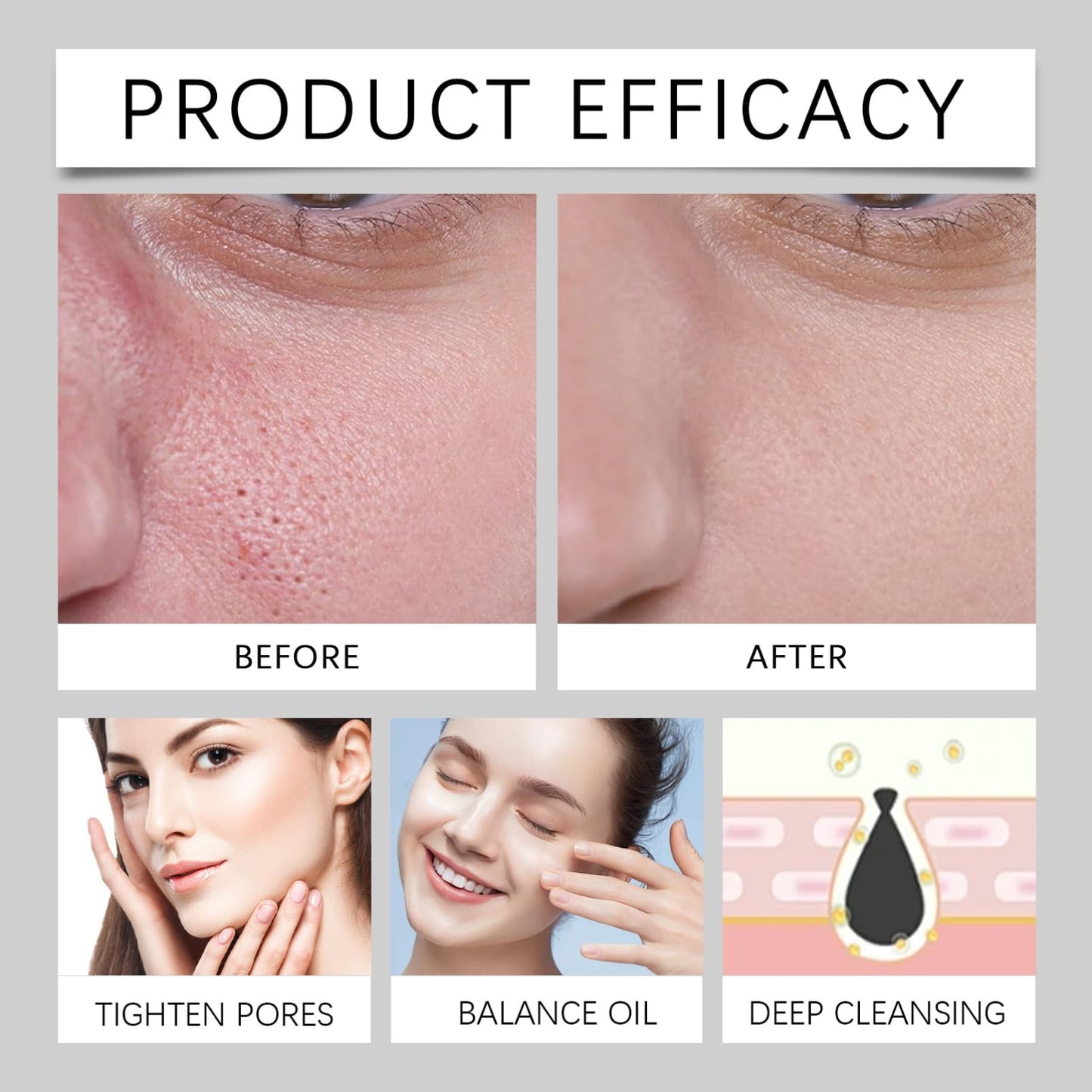 Cureluxe Minimizing Pores & Sebums Face Serum - Oil Control & Dark Spots Minimising Essence - Spicule Calm 1000 Pore-Refine + Heartleaf Extract, Deeply Purifies Pores, Relieve Irritation and Discomfort 30ml