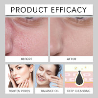 Cureluxe Minimizing Pores & Sebums Face Serum - Oil Control & Dark Spots Minimising Essence - Spicule Calm 1000 Pore-Refine + Heartleaf Extract, Deeply Purifies Pores, Relieve Irritation and Discomfort 30ml