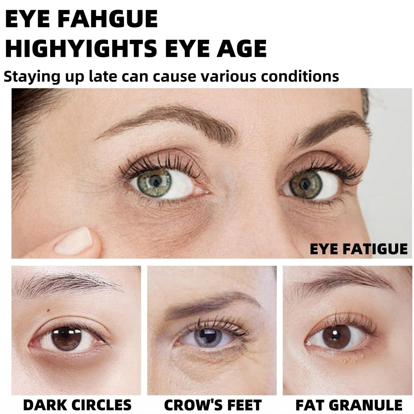 Fankayi Dissolving Micro-Needle Eye Patches,Anti Wrinkle Patches,Micro-Needle Patches for Dark Circles & Puffy Eyes,Under E-ye Gel Patches,Hydrating E-ye Patches,Hydro-gel E-ye Patches,E-ye Cooling Gel Pads
