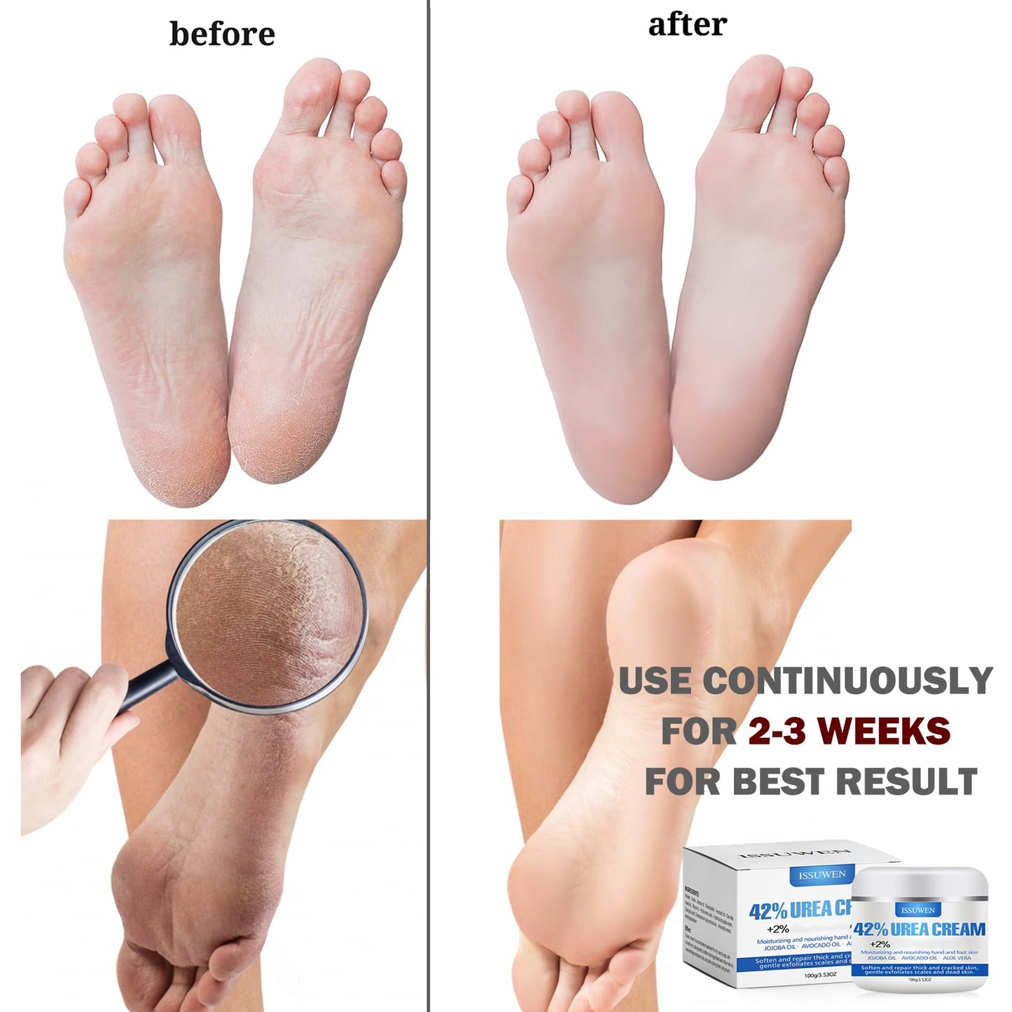 Urea 42% Foot Cream, Cracked Heel Repair Cream For Feet and Hand, Callus Remover For Dry And Hard Skin, Maximum Strength for Hand, Foot and Body Care, 100g (Original Scent)