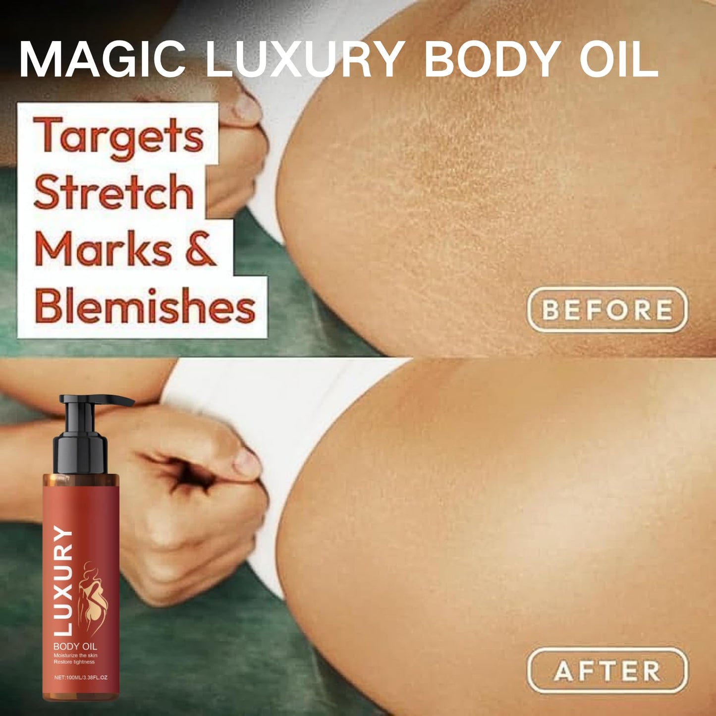 2 PCS Magic Luxury Body Oil for Women, Magic Firming Body Oils, Body Moisturizing Oil, Massage Oils for Scars Plumping And Moisturizing Body Butter For Arms, Chest, Thighs and Tums 100 ML