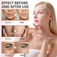 SingHao Frankincense Resin Oil,Moisturizing Frankincense Oil,Frankincen/se Resin Infused Oi/l for Face,Natural Anti-Aging Serum,Fra/nkincense O/il for Skin Care,Rapid Absorption Frankin/cense Re/sin O/il