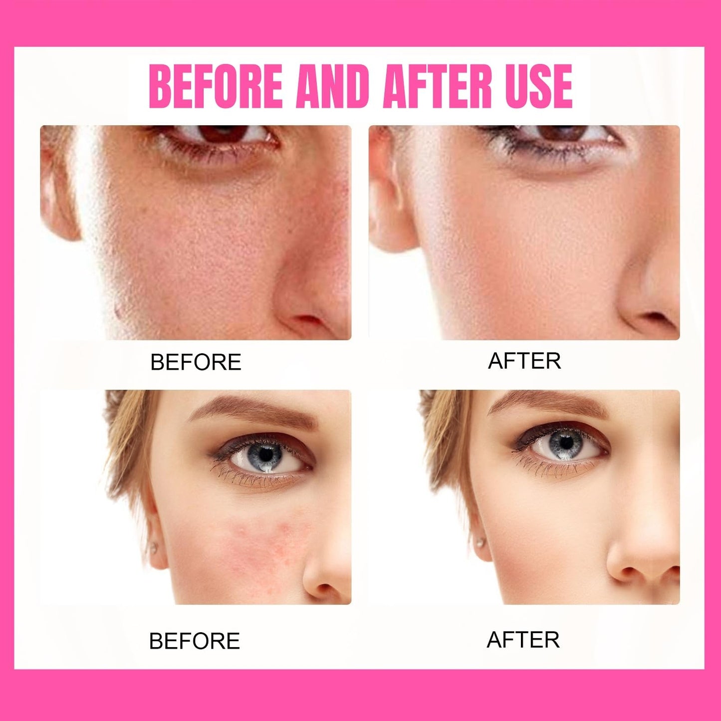 SingHao Peptide Balm Foundation,P/eptide Bounce Balm F/oundation,Hydrating Pe/ptide Balm Makeup,Fo/undation Full Coverage,Cream Fou/ndation,Coverage Balms Foun/dation M/akeup,Lightweight Makeup Foundation