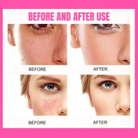 SingHao Peptide Balm Foundation,P/eptide Bounce Balm F/oundation,Hydrating Pe/ptide Balm Makeup,Fo/undation Full Coverage,Cream Fou/ndation,Coverage Balms Foun/dation M/akeup,Lightweight Makeup Foundation