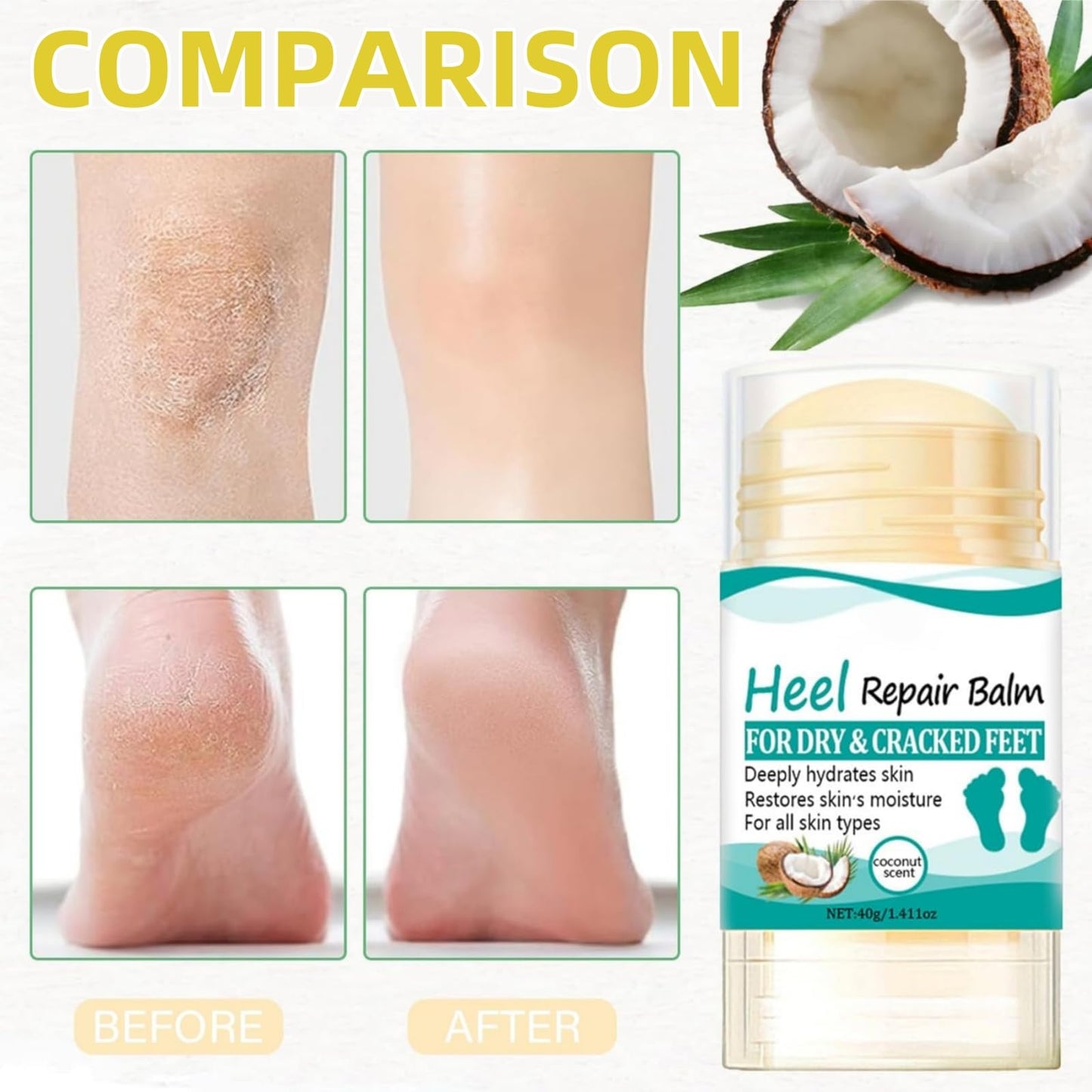 Yoowan Coconut Heel Balm Stick,Foot Cream for Very Dry Feet,Cracked Heel Repair Cream,Foot Moisturiser,Fo-Ot Cre-Am For Hard Skin,Softening & Removing Hard Skin,Deep Moisturizing,For Body Hands&Feet Knees