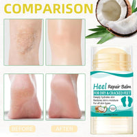Yoowan Coconut Heel Balm Stick,Foot Cream for Very Dry Feet,Cracked Heel Repair Cream,Foot Moisturiser,Fo-Ot Cre-Am For Hard Skin,Softening & Removing Hard Skin,Deep Moisturizing,For Body Hands&Feet Knees