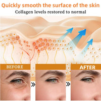 Anti Aging Firming Body Cream,Bee Ven-Om Cream,Bee Ven-Om Cre-Am For Wrinkles,Skin Firming Body Cre-Am,Restore Elasticity,Hydrate And Moisturize,Brighten Skin Tone,Non-Irritating,For Body And Face