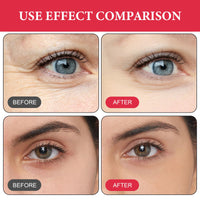 Retinol Eye Cream 2 PCS
